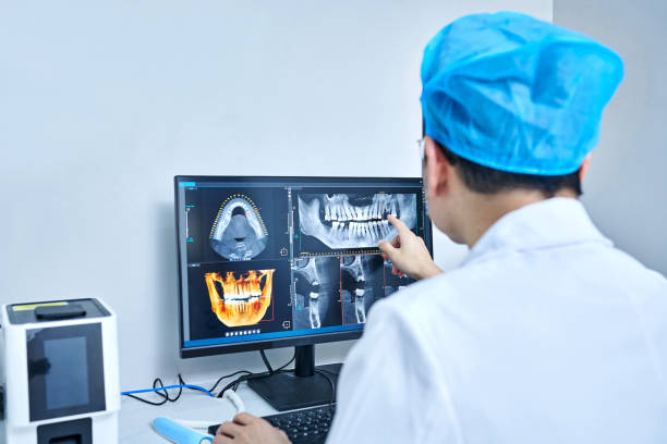 Best Urgent Care for Lost Fillings or Crowns in North Liberty, IA